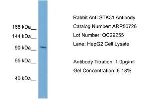 WB Suggested Anti-STK31  Antibody Titration: 0. (STK31 anticorps  (N-Term))