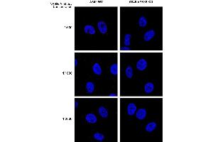 Immunocytochemistry/Immunofluorescence analysis using Mouse Anti-VPS35 Monoclonal Antibody, Clone 5A9 (ABIN6932936).