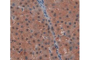 Used in DAB staining on fromalin fixed paraffin- embedded Kidney tissue