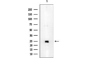 Western blot analysis of lysates from Mouse heart, using AQP2 Mouse Monoclonal Antibody at 1/1000 dilution.