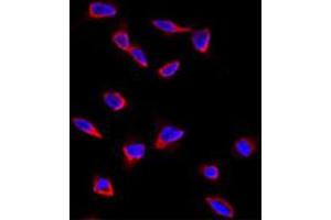 Immunofluorescence analysis of SOX9 polyclonal antibody  in HeLa cells. (SOX9 anticorps  (N-Term))