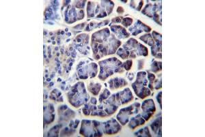 anti-PC (AA 53-82), (N-Term) antibody