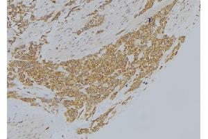 ABIN6273008 at 1/100 staining Human lung tissue by IHC-P. (MICAL1 anticorps  (Internal Region))