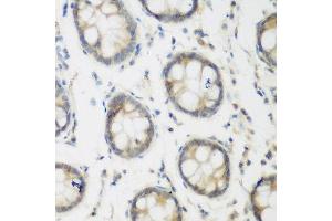 Immunohistochemistry of paraffin-embedded human colon using ACCS antibody at dilution of 1:200 (40x lens). (PHACS anticorps)