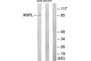 Western Blotting (WB) image for anti-Phosphofructokinase, Liver (PFKL) (AA 691-740) antibody (ABIN2889409) (PFKL anticorps  (AA 691-740))