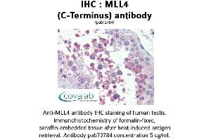 Image no. 2 for anti-Histone-Lysine N-Methyltransferase MLL4 (MLL4) (C-Term) antibody (ABIN1736980) (MLL4 anticorps  (C-Term))