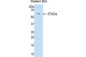 Detection of Recombinant PI16, Mouse using Polyclonal Antibody to Peptidase Inhibitor 16 (PI16)