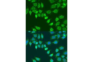 Immunofluorescence analysis of U2OS cells using L2HGDH antibody (ABIN6293250) at dilution of 1:100.