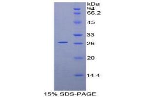 SDS-PAGE analysis of Mouse Prion Protein. (PRNP Protéine)
