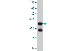 Western Blot detection against Immunogen (37.