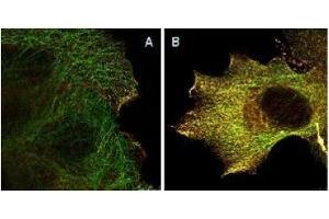 Immunofluorescence (IF) image for anti-V-Akt Murine Thymoma Viral Oncogene Homolog 1 (AKT1) (Ser473) antibody (ABIN400784) (AKT1 anticorps  (Ser473))