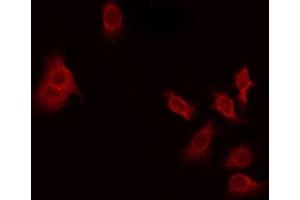 ABIN6275628 staining Hela by IF/ICC. (THAP4 anticorps  (Internal Region))