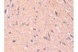 DAB staining on IHC-P; Samples: Rat Spinal cord Tissue