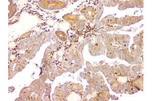 IHC analysis of ARA9/AIP using anti-ARA9/AIP antibody (ABIN6719423).