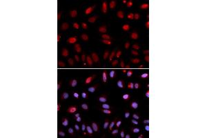 Immunofluorescence analysis of U2OS cells using HUS1 antibody (ABIN6131777, ABIN6142085, ABIN6142087 and ABIN6221056).