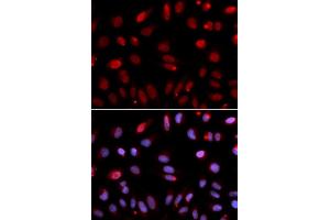 Immunofluorescence analysis of U2OS cells using HUS1 antibody (ABIN6131777, ABIN6142085, ABIN6142087 and ABIN6221056). (HUS1 anticorps  (AA 1-280))
