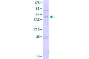 Image no. 1 for Chromosome 18 Open Reading Frame 55 (C18orf55) (AA 1-248) protein (GST tag) (ABIN1347253)