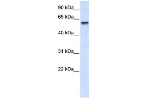 WB Suggested Anti-TRIM41 Antibody Titration:  0. (TRIM41 anticorps  (Middle Region))
