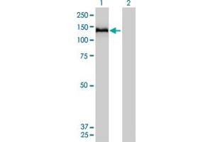 Western Blot analysis of COL6A2 expression in transfected 293T cell line by COL6A2 monoclonal antibody (M01), clone 2C5-F2. (COL6A2 anticorps  (AA 1-425))