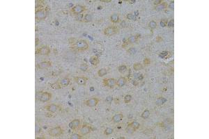 Immunohistochemistry of paraffin-embedded rat brain using GGA2 Antibody.