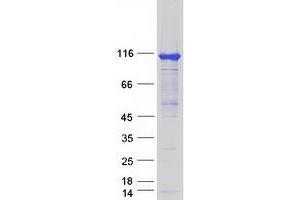Validation with Western Blot