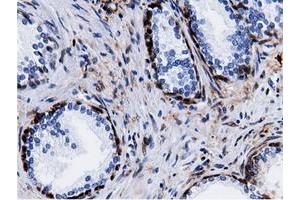 Immunohistochemical staining of paraffin-embedded Human liver tissue using anti-QPRT mouse monoclonal antibody. (QPRT anticorps)