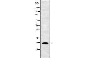 Western blot analysis of PPP3R1 using MCF7 whole cell lysates (PPP3R1 anticorps  (Internal Region))