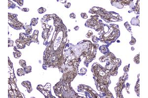 IHC analysis of Collagen IV using anti-Collagen IV antibody .