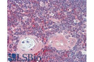 ABIN5539807 (5µg/ml) staining of paraffin embedded Human Thymus.