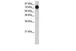 Image no. 2 for anti-Zinc Finger Protein 16 (ZNF16) (N-Term) antibody (ABIN6736214)
