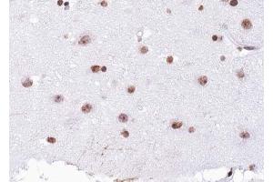 ABIN6267063 at 1/100 staining human Brain tissue sections by IHC-P.