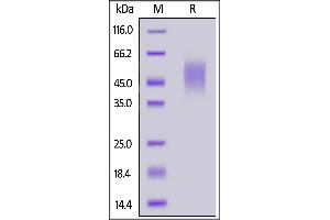 Mouse IL-2 R gamma, His Tag on  under reducing (R) condition. (IL2RG Protein (AA 23-263) (His tag))