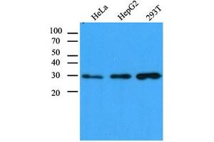 Western Blotting (WB) image for anti-Carbonyl Reductase 1 (CBR1) antibody (ABIN614308) (CBR1 anticorps)