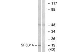 Western blot analysis of extracts from HepG2 cells, using SF3B14 Antibody. (Pre-mRNA Branch Site Protein p14 (SF3B14) (AA 76-125) anticorps)