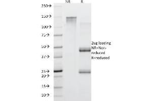 SDS-PAGE Analysis Purified MUC5AC Mouse Monoclonal Antibody (45M1). (MUC5AC anticorps)