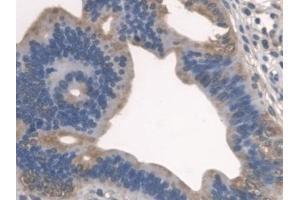 Detection of SPTLC1 in Mouse Uterus Tissue using Polyclonal Antibody to Serine Palmitoyltransferase, Long Chain Base Subunit 1 (SPTLC1)