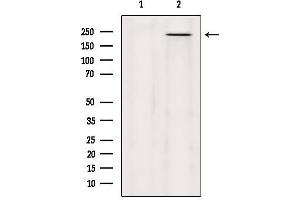 Western blot analysis of extracts from Hela, using MYO5C Antibody. (MYO5C anticorps)