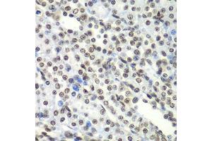 Immunohistochemistry of paraffin-embedded rat kidney using SF3B2 antibody.