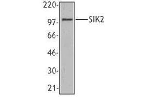 Western Blotting (WB) image for anti-Salt-Inducible Kinase 2 (SIK2) antibody (ABIN2666364) (SIK2 anticorps)