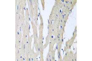 Immunohistochemistry of paraffin-embedded rat heart using PITRM1 antibody (ABIN5974837) at dilution of 1/100 (40x lens). (PITRM1 anticorps)