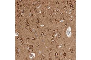 Immunohistochemical staining of human cerebral cortex with RRP15 polyclonal antibody  shows strong cytoplasmic positivity in neuronal cells at 1:200-1:500 dilution. (RRP15 anticorps)