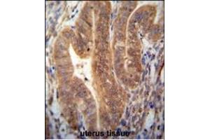 KI antibody (N-term) (ABIN654385 and ABIN2844131) immunohistochemistry analysis in formalin fixed and paraffin embedded human uterus tissue followed by peroxidase conjugation of the secondary antibody and DAB staining. (SHISAL1/KIAA1644 anticorps  (N-Term))