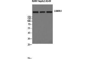 Western Blotting (WB) image for anti-Laminin, alpha 5 (LAMA5) antibody (ABIN5957135) (Laminin alpha 5 anticorps)