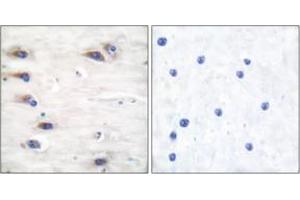 Immunohistochemistry analysis of paraffin-embedded human brain, using KSR (Phospho-Ser392) Antibody.