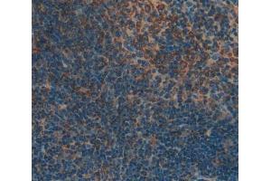 Used in DAB staining on fromalin fixed paraffin- embedded Kidney tissue