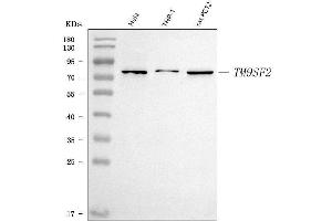 anti-Transmembrane 9 Superfamily Member 2 (TM9SF2) (AA 66-596) antibody