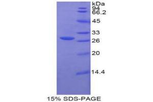 SDS-PAGE analysis of Human Glucuronidase beta Protein. (Glucuronidase beta Protéine)