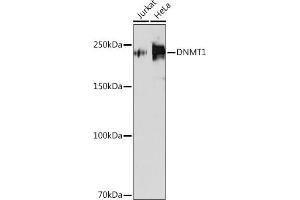 Western blot analysis of extracts of various cell lines, using DNMT1 antibody (ABIN7266808) at 1:1000 dilution.