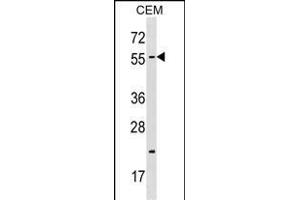 CBX4 Antibody (N-term) (ABIN1538811 and ABIN2848679) western blot analysis in CEM cell line lysates (35 μg/lane). (CBX4 anticorps  (N-Term))