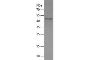 Western Blotting (WB) image for Ankyrin Repeat and SOCS Box Containing 17 (ASB17) (AA 76-295) protein (His-IF2DI Tag) (ABIN7121835)